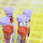 close-up of blood test tubes with colored caps in a storage rack