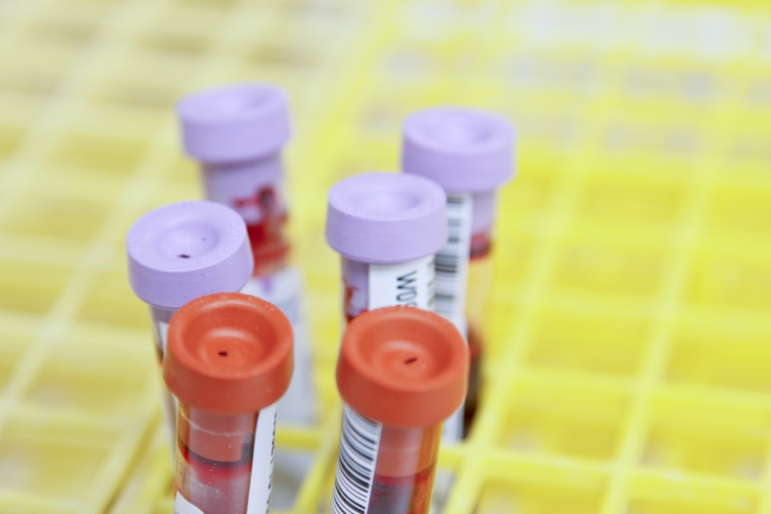 close-up of blood test tubes with colored caps in a storage rack